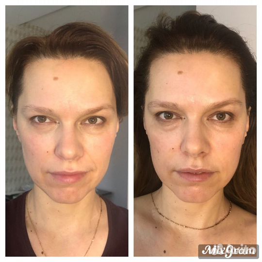 Массаж лица и тела