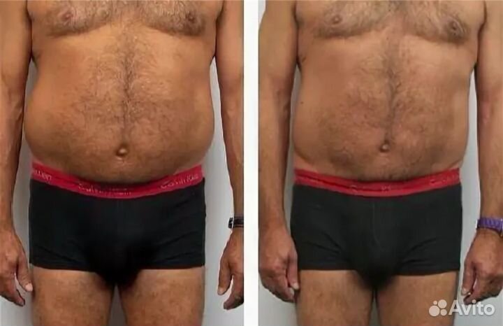 LPG массаж для мужчин