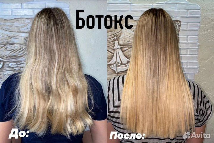 Нанопластика floractive, ботокс, биксипластия