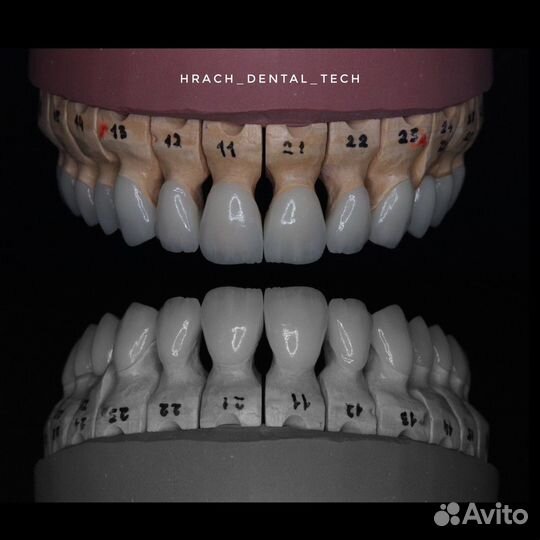 Зубной техник керамист сотрудничество с врачами