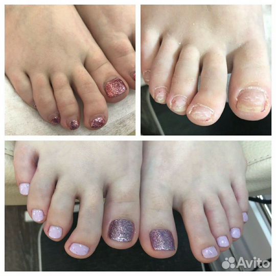 Маникюр- Педикюр