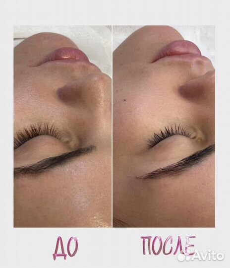 Ультразвуковая чистка