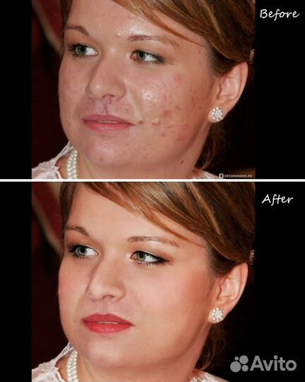 Услуги фотошопа (удаление водяного знака и другое)