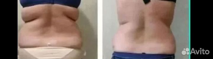 Стройное тело, упругость кожи, лифтинг на индиба