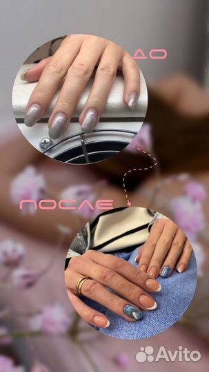 Выравнивание ногтевой пластины