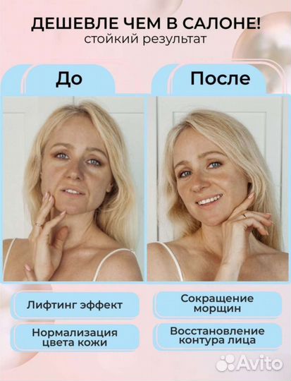 Косметический аппарат, массажер RF EMS лифтинг Нов