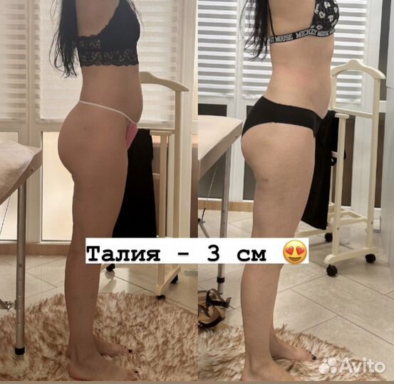 Массаж аппаратный. EMS sculpt