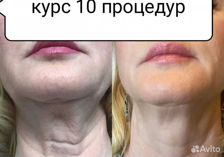 Маска для лица