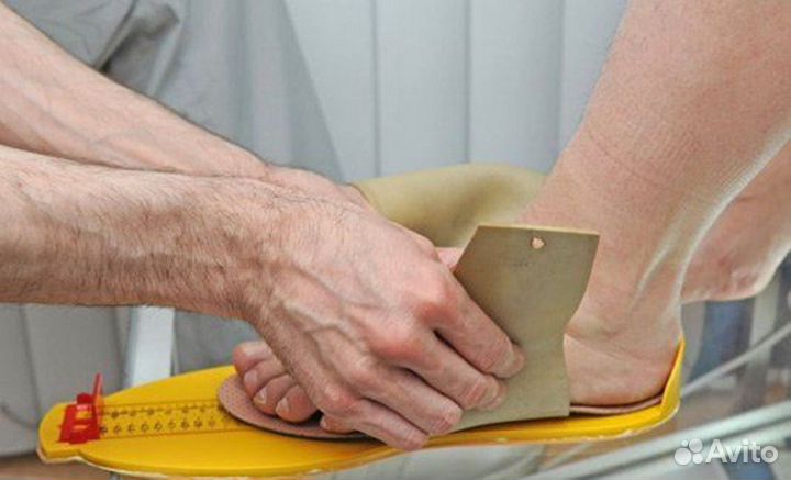 Изготовление индивидуальных ортопедических стелек