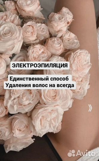 Электроэпиляция