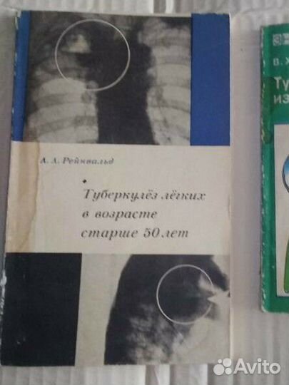 Туберкулёз легких в возрасте от 50 лет