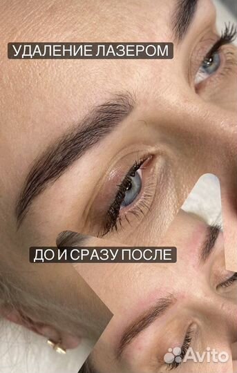 Бесплатно 30.07 Модели 20-25 лет на татуаж