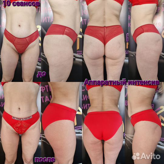 Антицеллюлитный курс, аппаратный массаж