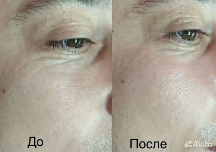 Маска для лица