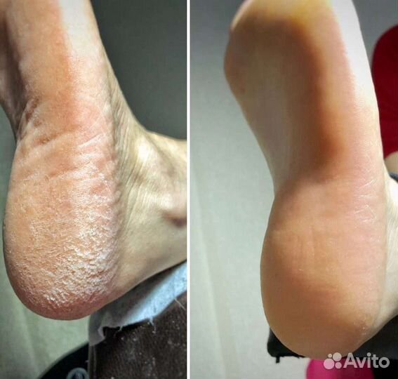 Маникюр,педикюр