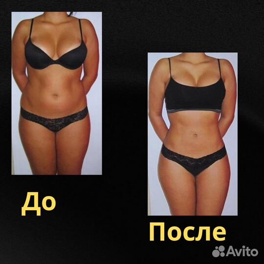 Коррекция фигуры. Аппаратный массаж. Похудение