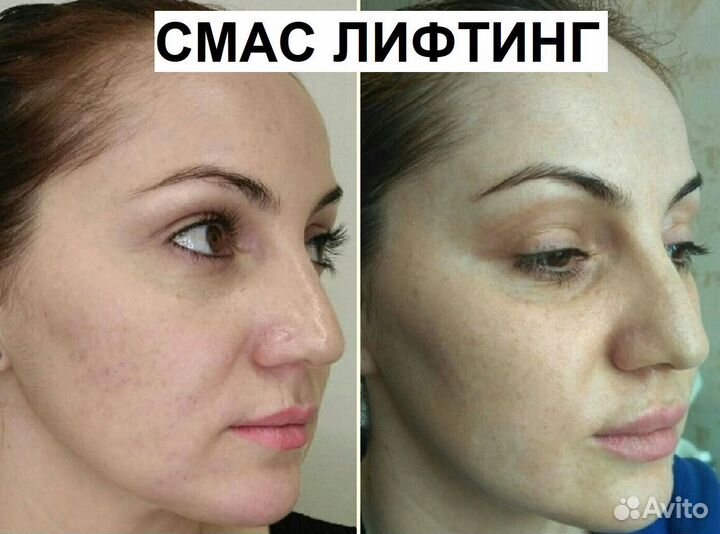 Четкий овал лица