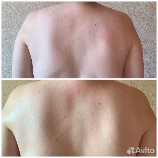 Массаж классический