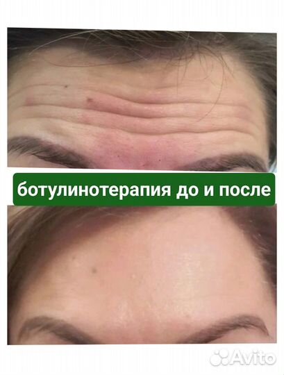 Услуги косметолога