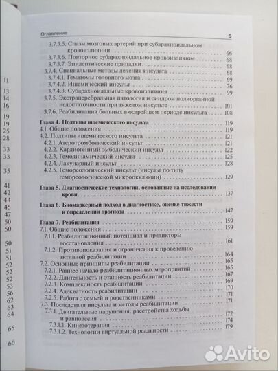 Книга. Инсульт