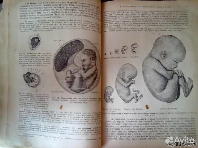 Антикварная медицинская книга 