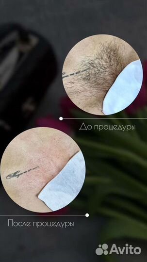 Модель на депиляцию