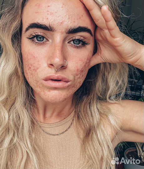 Обработка фотографий / Фотошоп / Ретушь фотографий