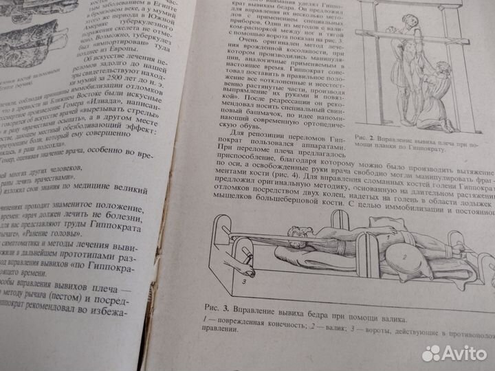 Книга по медицине Травматология и ортопедия Юмашев
