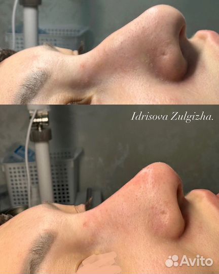 Услуги косметолога