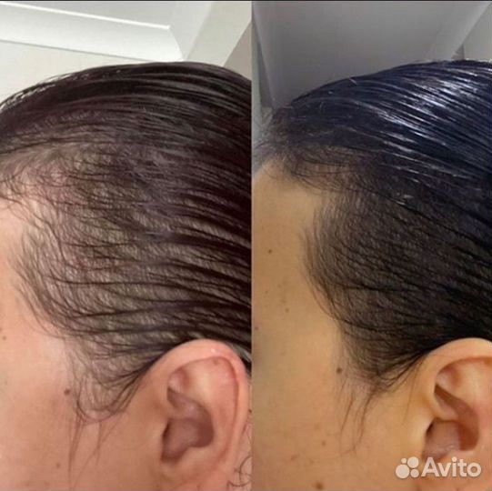 Шампунь для роста волос