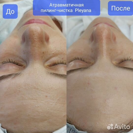 Депиляция/Обучение. Косметология. Кирсанов