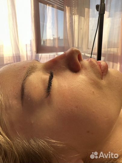 Косметлог увеличение губ