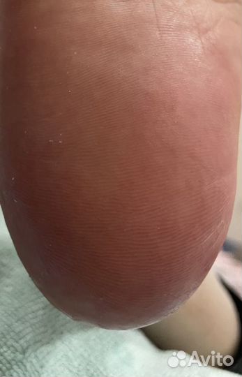 Аппаратный педикюр