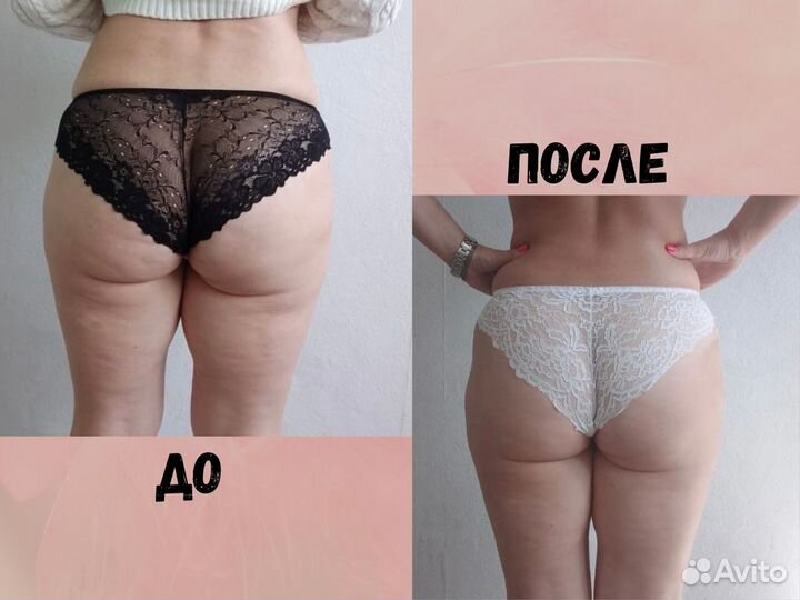 Массаж / Антицеллюлитный / Аппаратный массаж