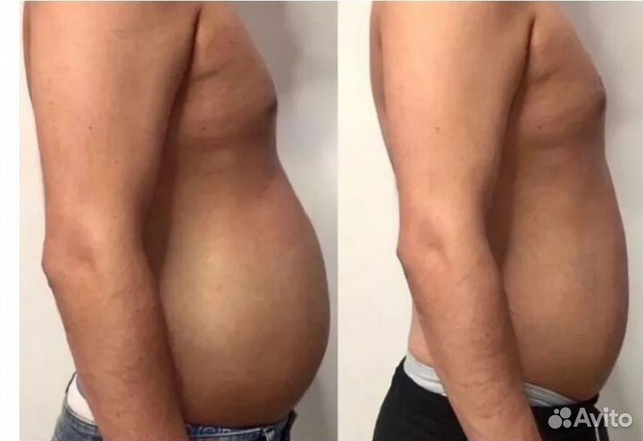 Ищу модель на криолиполиз