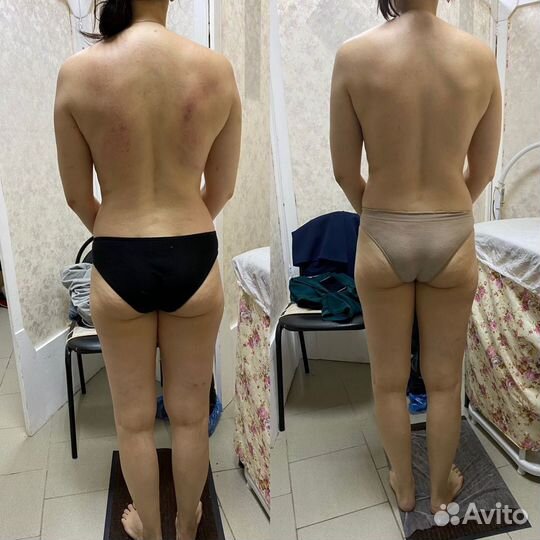 Коррекция фигуры