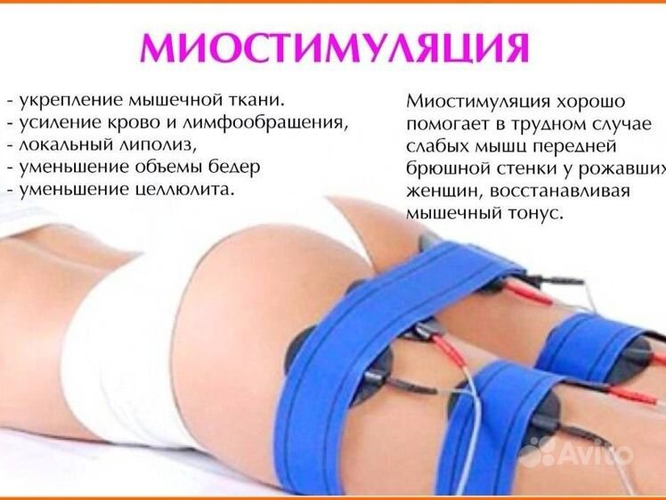 Миостимулятор до и после отзывы