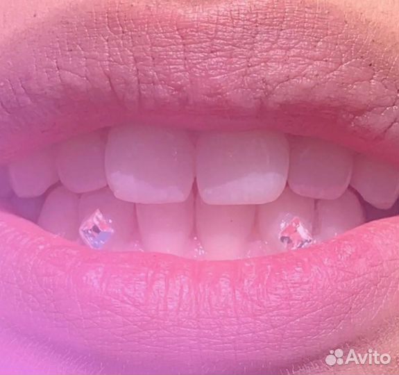 Стразы на зубки(без сверления)безопасный метод