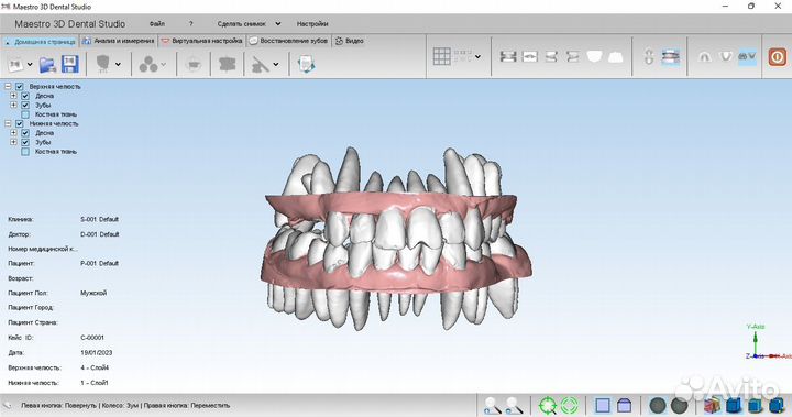 Maestro 3D Dental Studio 6.0 3shape OrthoAnalyzer