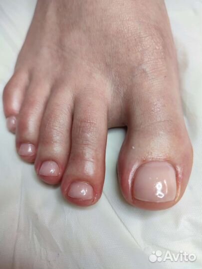 Педикюр (Заволга-Тверицы)