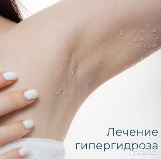 Лечение гипергидроза