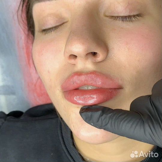 Модель на увеличение губ