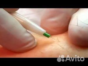 Электро эпилятор удаление волос на лице, теле, США