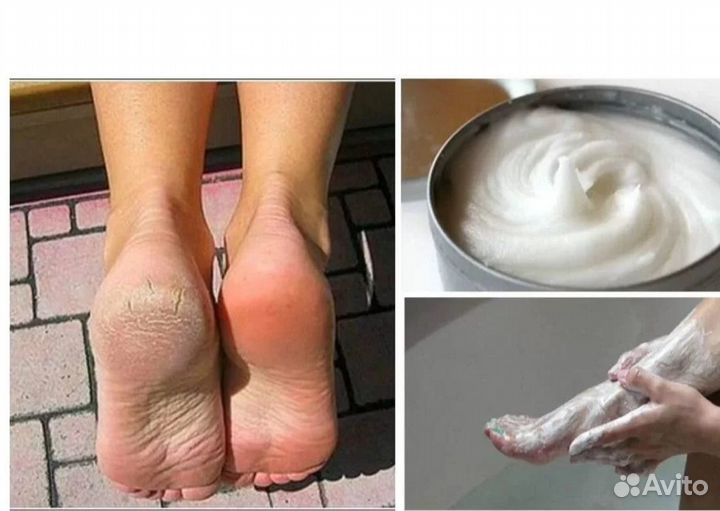 Средство, убирающее грибок ногтей и кожи