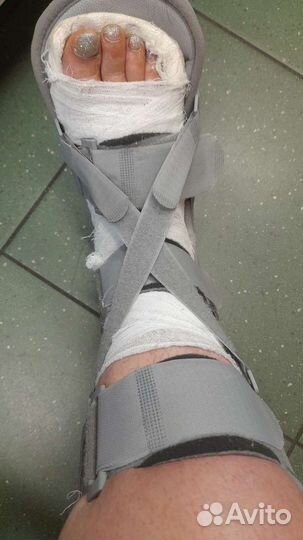 Лангетка на ногу