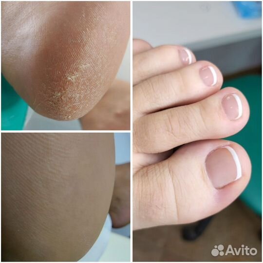 Мастер маникюра