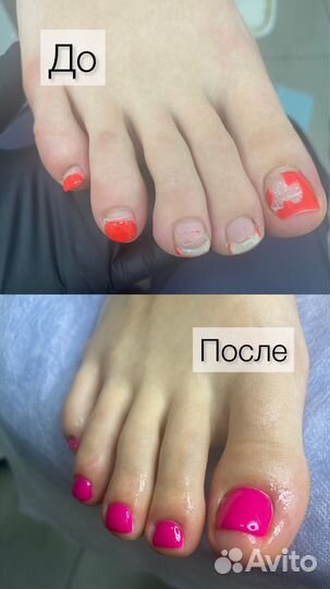 Аппаратный маникюр педикюр