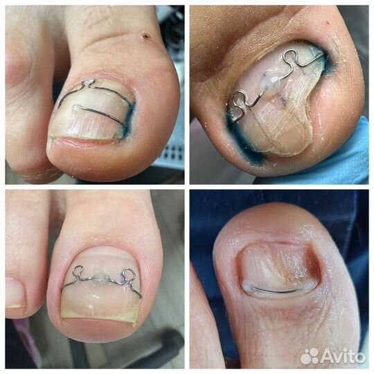 Услуги подолога