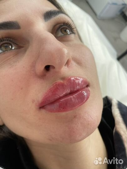 Врач косметолог