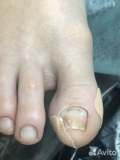 Маникюр с покрытием гель-лаком